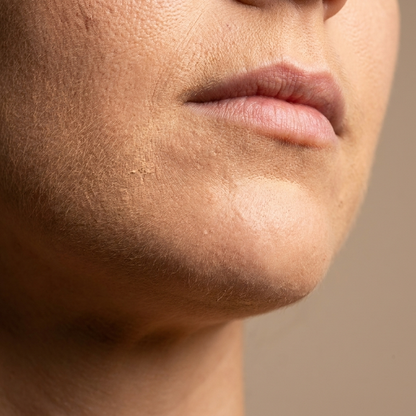 Lienzo - Foto 3 Before: piel con peach fuzz y base con textura